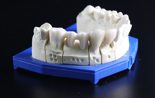 入れ歯の模型