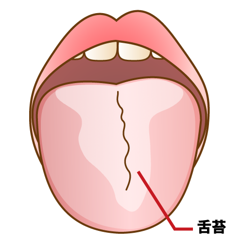 舌垢
