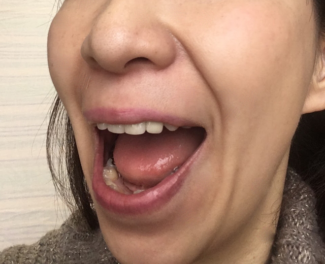 口腔内における唾液の役割
